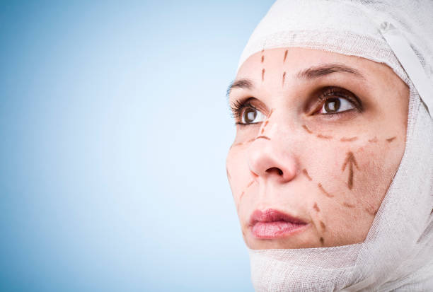 yuz-kafa-yeniden-yapilandirma